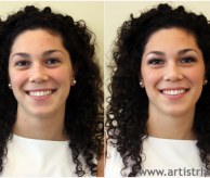 Before & After