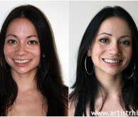Before & After