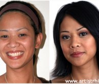 Before & After