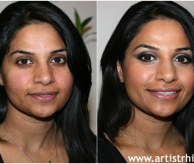 Before & After