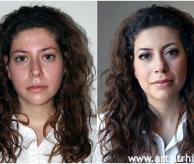 Before & After
