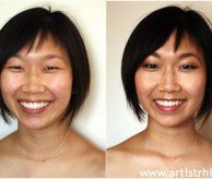 Before & After